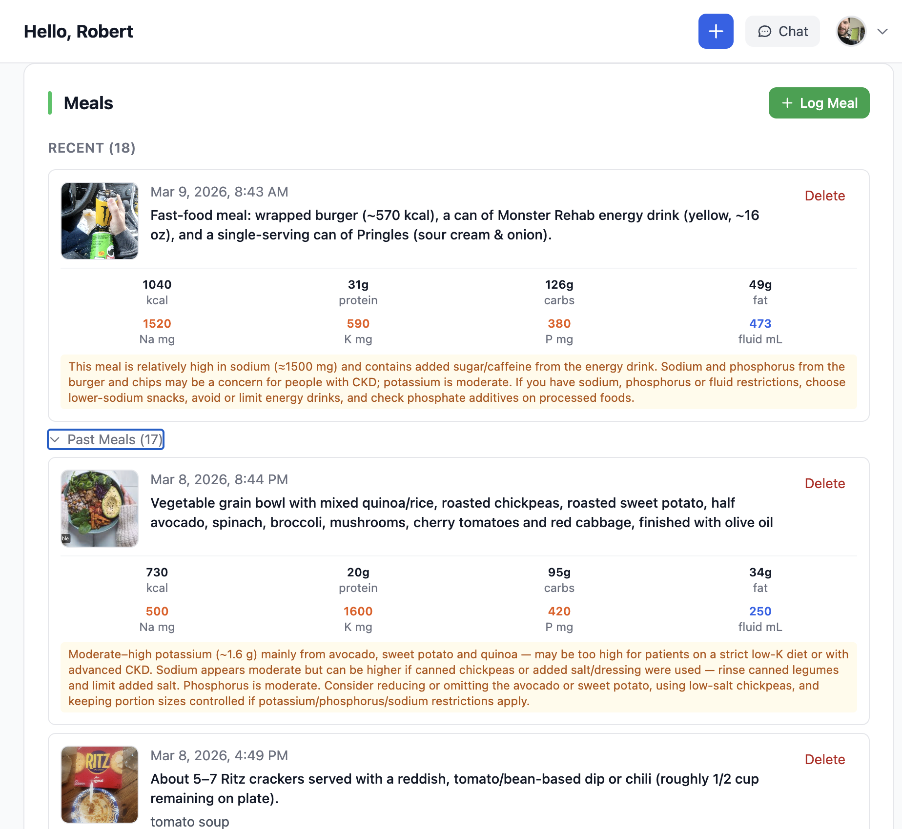 AI Meal Scanning and Nutrition Tracking